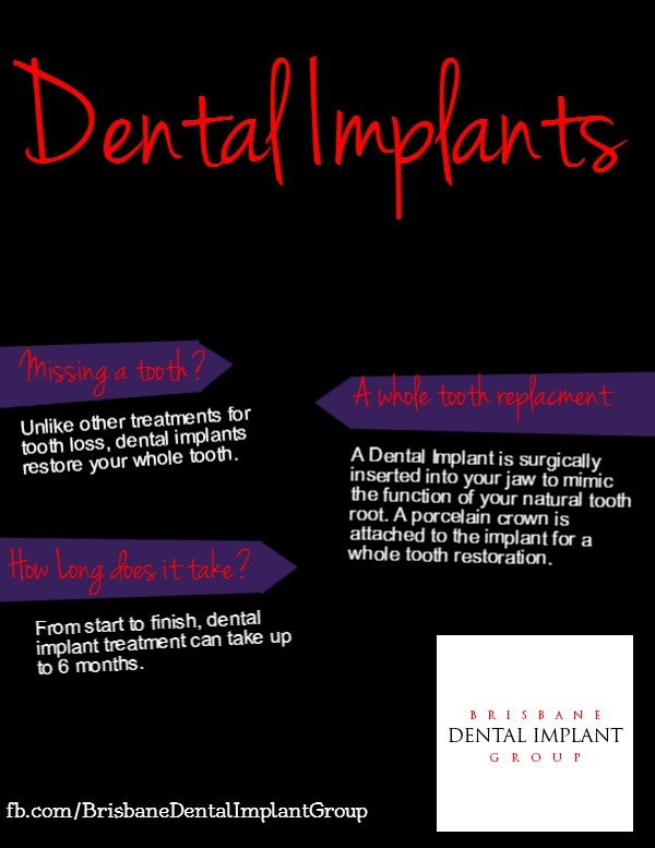 Brisbane Dental Implant Group