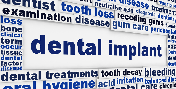 dentalimplants banner