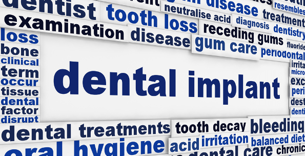 dentalimplants banner