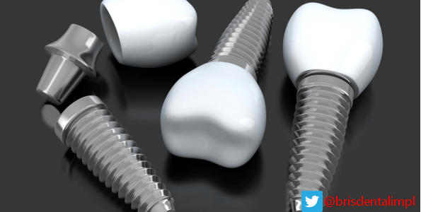 Dental Implant Screws and Crowns