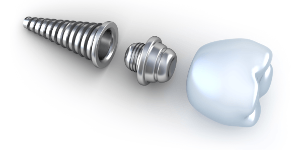 Implant Dentistry: The Brisbane Dental Implant Group offers comprehensive dental implant treatment.
