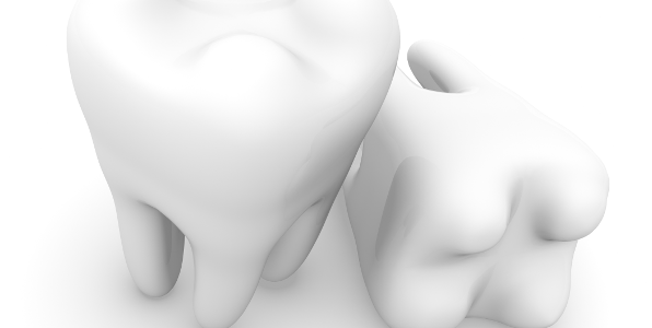 Can dental veneers replace missing teeth?