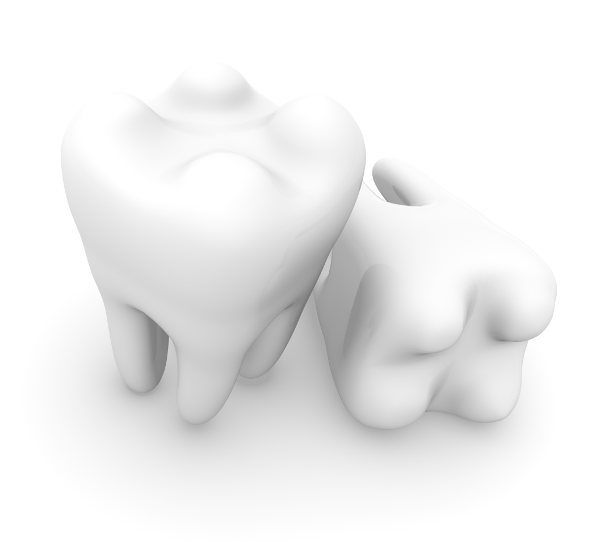 Can dental veneers replace missing teeth?