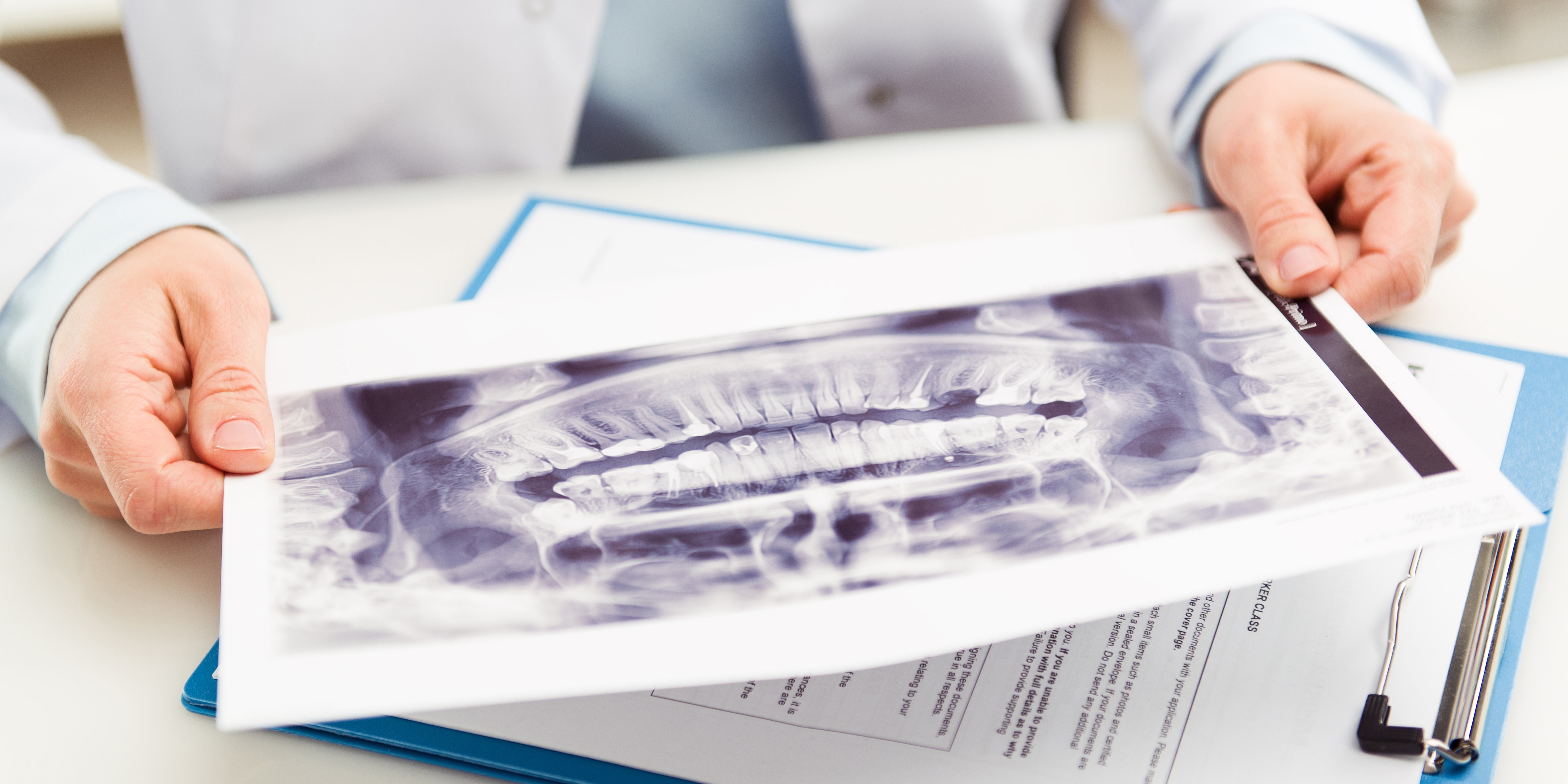 best dental implants brisbane