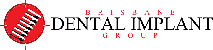 Meet The Team at Brisbane Dental Implant Group